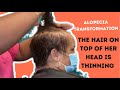 The top of her head is thinning| Alopecia Transformation | Androgenic Alopecia Transformation