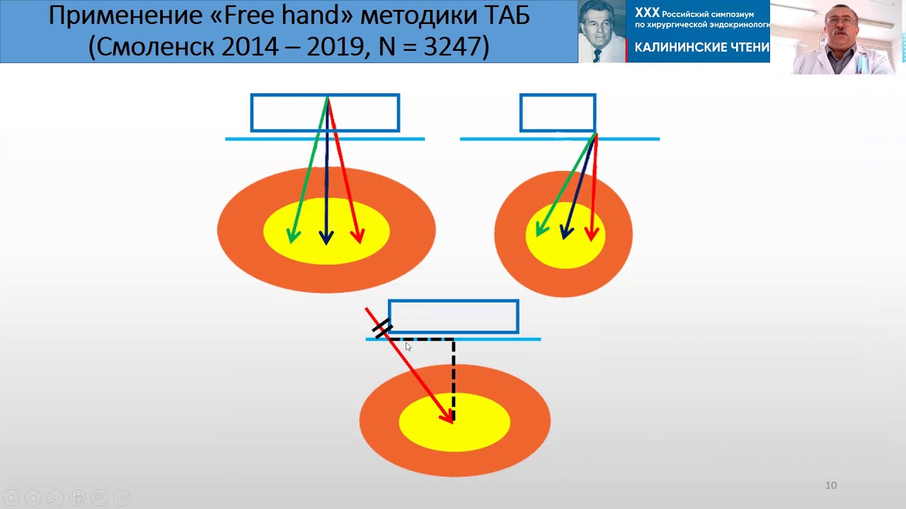 Борсуков А.В. ТОНКОИГОЛЬНАЯ ВАКУУМНАЯ АСПИРАЦИОННАЯ БИОПСИЯ С УЗИ ...