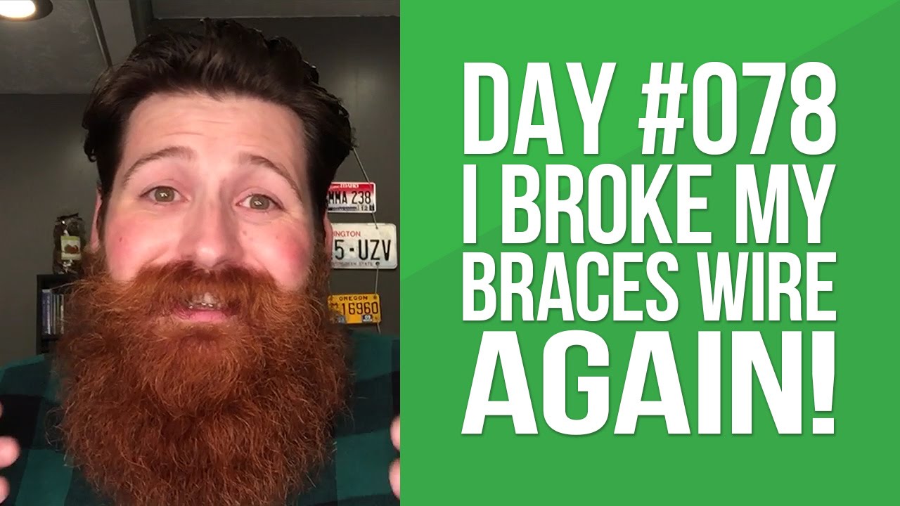 Day 078 My Braces Wire Broke AGAIN! YouTube