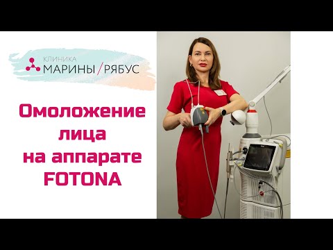 Лазерное омоложение Fotona 4D