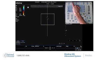 Mindray M6 Ultrasound Machine - Imaging Modes Review