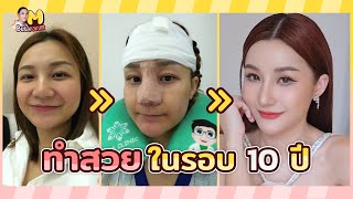 ศัลยกรรมทำดั้งซีรี่4และโมหน้าผาก ทำที่ไหน?เจ็บไหม?แพงไหม? มาดูกัน | M Busarakum Vlog.1