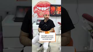 Damağda yaranan iltihab ☝️#stomatitis #gingivitis #dentist #youtube