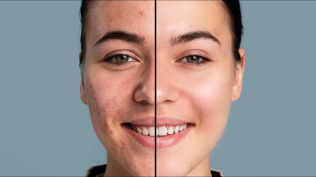 Face ko Smooth kaise kare High End Skin Retouching