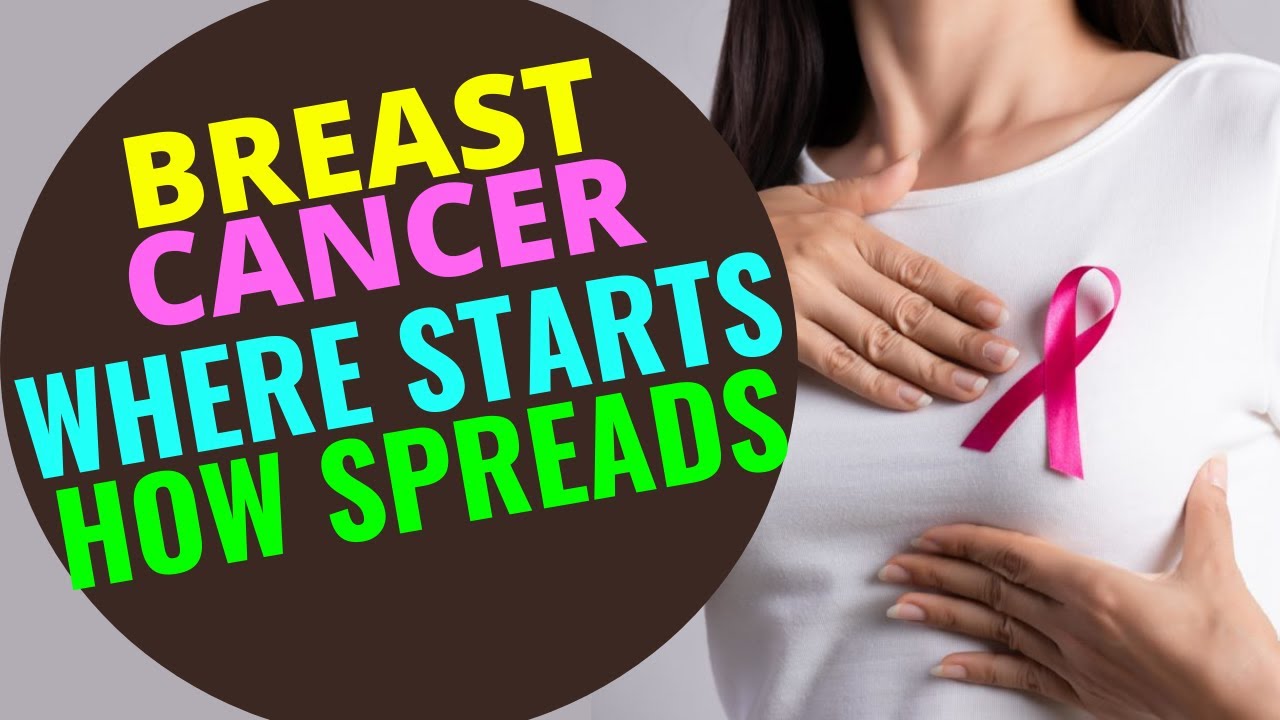 Where Breast Cancer Starts And Spreads How Breast Cancer Spreads Nursing Exercise Youtube