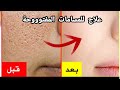 حبسي ما تخسري دراهمك فكل منتج يخرج الفرق في اول شهر غيري بشرتك للأحسن اكسبلور Viral Skincare 