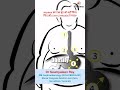 शराब नहीं पी फिर भी Liver Cirrhosis? जानिए असली कारण | Best Gastroenterologist in Varanasi #doctor