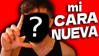 Thumbnail for esta es... MI NUEVA CARA (después de las cirugías)