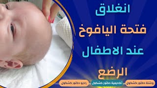 انغلاق فتحة اليافوخ عند الرضع: متى يجب القلق وكيف تتابع صحة طفلك؟ screenshot 5