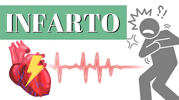 Quais são os sinais de infarto ou AVC?