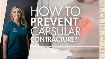Tuesday Tips | Reducing the Risks of Capsular Contracture