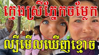 កូនស្រីភ្នែកប្រាក់ ល្បីមើលឃើញពួកអមនុស្ស កែវភ្នែកពិតជាស្រស់ស្អាតណាស់