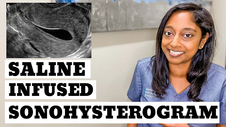 SALINE INFUSED SONOHYSTEROGRAM