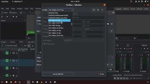 28 What is manage project profiles