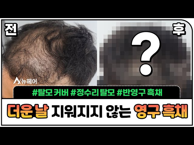 더운 여름! 물에도 지워지지 않아 너무 편한 영구 흑채ㅣ뉴헤어