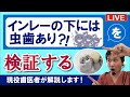 夢デンLIVE【インレーの下には虫歯有り!?】を検証する