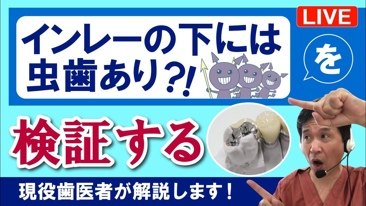 夢デンLIVE【インレーの下には虫歯有り!?】を検証する