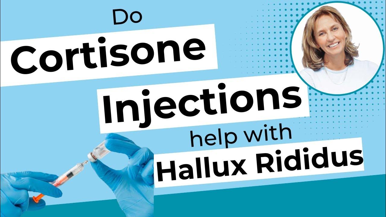 Do Cortisone injections help with Hallux Rigidus/ Hallux Limitus? YouTube