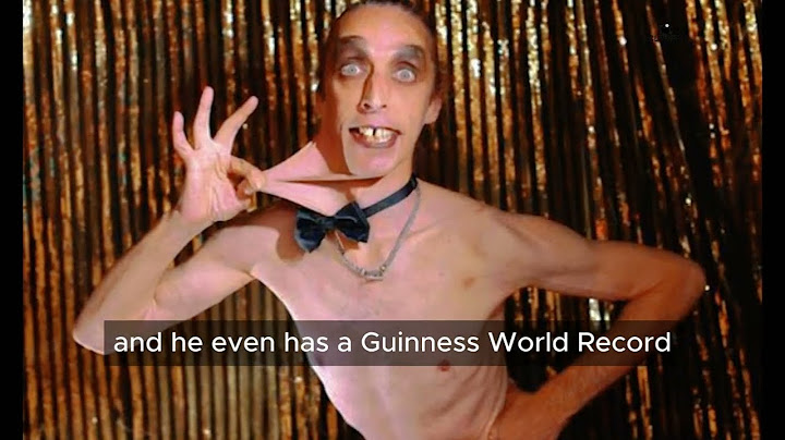 Meet Garry Turner | Stretchiest Skin | The Man with the World's Stretchiest Skin! 😲