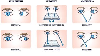 Eye convergence test (near-point convergence / vergence test):