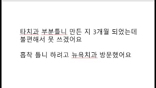 [부산흡착틀니] 타치과에서 부분틀니를 3개월전에 했는데 불편해서 못쓰겠어요 흡착틀니 가능할까요?(광안리 뉴욕치과 6-13-8)