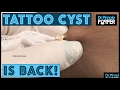 Welcome Back, Tattoo & Chit Chat! Dr Pimple Popper