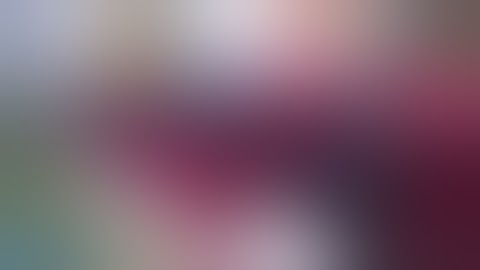 VTI InterFuse S Insertion - Dr. Asdourian