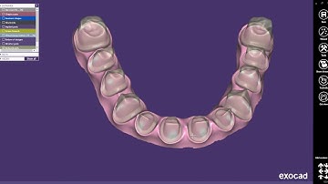 exocad Quick Guide Using the Cutback Library Thimble