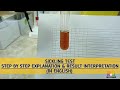 Sickling Test.Sickling solubility test.Detailed Practical step by step explaination.Qualitative test