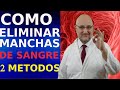 COMO QUITAR MANCHAS de SANGRE  - 2 METODOS 💡💡