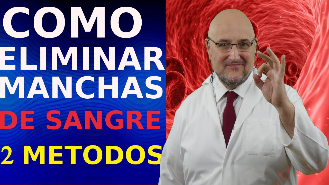 COMO MANCHAS de SANGRE - 2 💡💡 YouTube