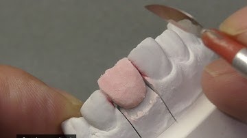 Super Porcelain EX-3 Direction for Use – Body, Enamel, Translucent –