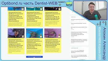 АНОНС - optibond.ru 50 клинических примеров бесплатно- 2025 #rubberdamology #DentistWEB - Часть 4 4K