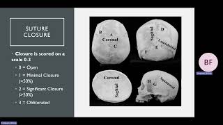 Lab 7: Human Skeletal Variation Lecture