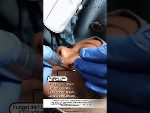 Video: Bolehkah anda menggunakan electrocautery dengan perentak jantung?