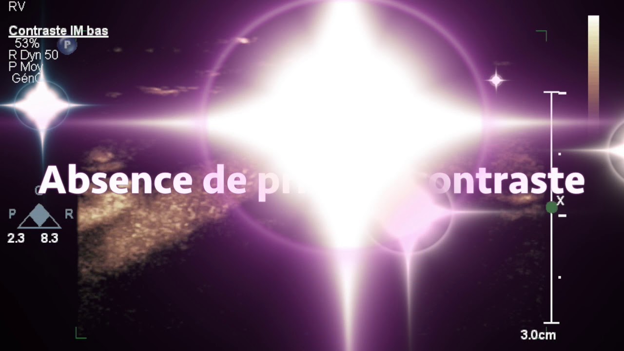 Mon film 3 video phone beyonce mp3