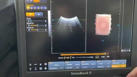 chison sonobook 9 - how to save user defined preset