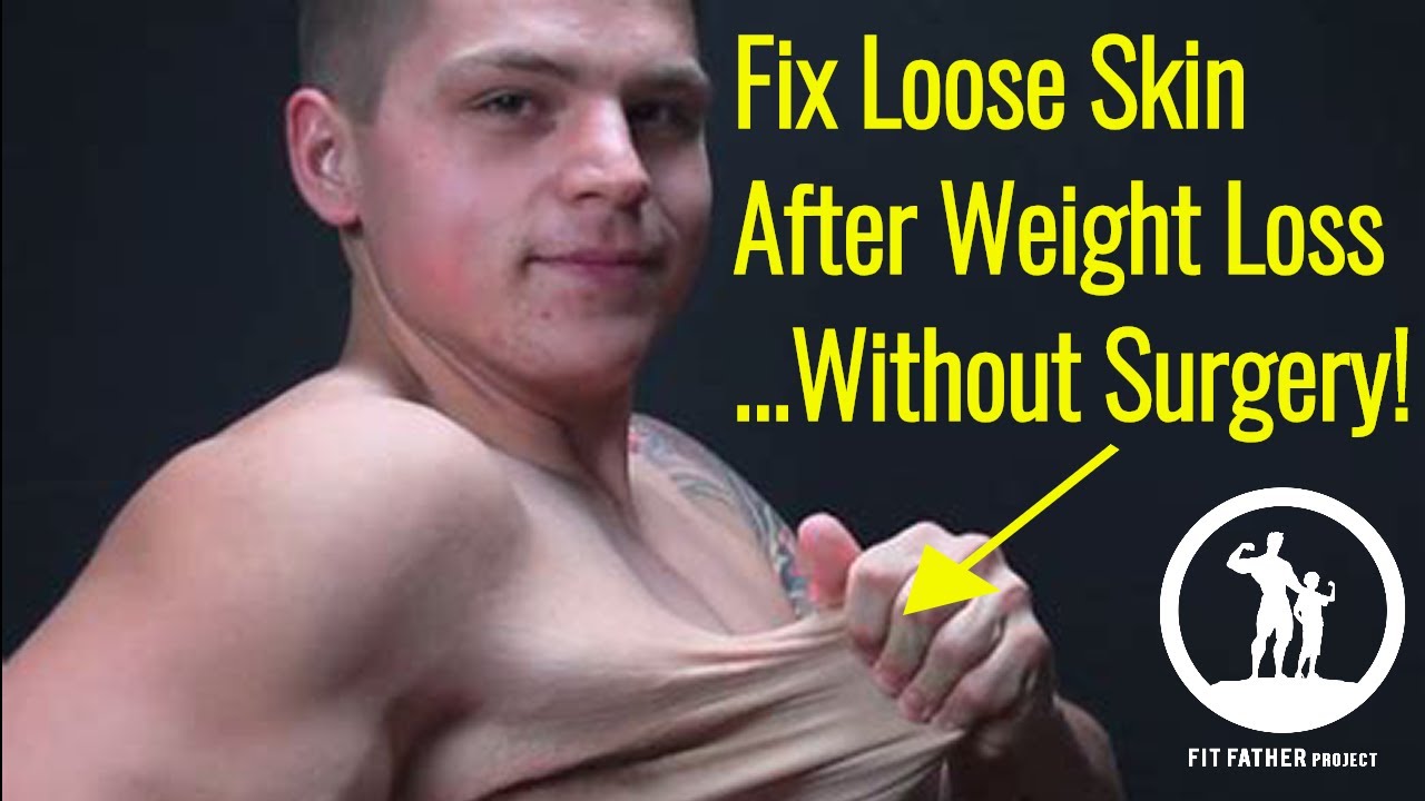 How To Fix Loose Skin After Weight Loss Men Without ...