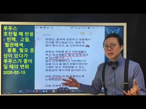 흉통, 고열, <strong>빈맥</strong> 증상의 루푸스가 호전된 경우 Lupus Symptoms &amp;amp; Progress