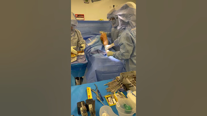 Getting ready for knee replacement #surgery #orthopedics