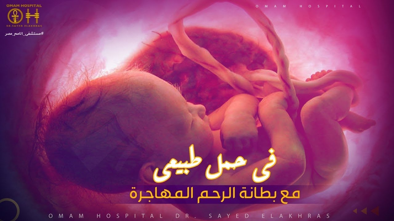 مين قال مفيش حمل مع بطانة الرحم المهاجرة ... كله يقولها مبروك 😍