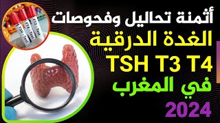 ثمن تحاليل الغدة الدرقية بالمغرب تحليل TSH تحليل T4 تحليل T3