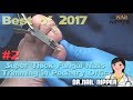 #2 Best of 2017 - Super Thick Fungal Nails Trimming in Podiatry Office - Dr Nail Nipper