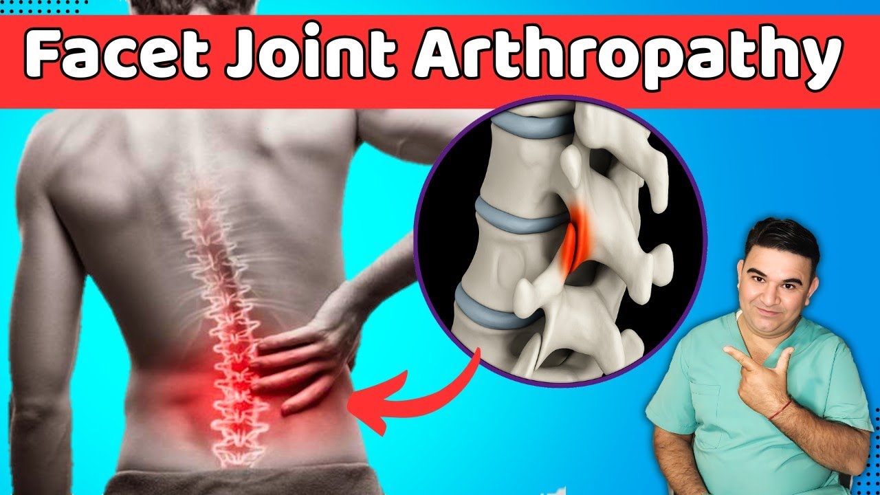 🔥 Facet Joint Pain Explained! 😱 Avoid These Exercises & Do THIS for Instant Relief!