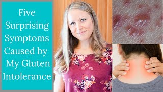 Uncommon Symptoms I Experienced from Celiac Disease | Unusual Signs to Watch for & When to See a Doc