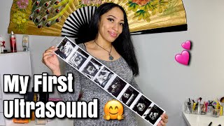 FIRST ULTRASOUND &amp; HEARING BABY’S HEARTBEAT(First Time Mom)| 16 Weeks Pregnant: First Doctor’s Visit