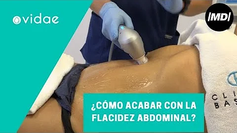 Qual o melhor tratamento para flacidez no abdômen?