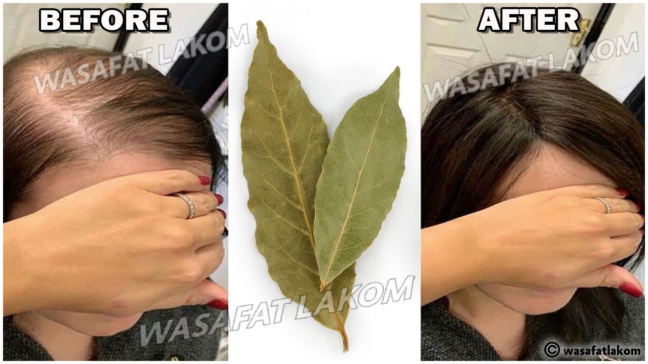 Details 78+ japanese remedies for hair growth latest in.eteachers