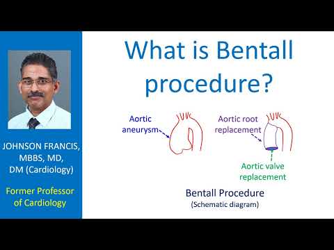 What is Bentall procedure?