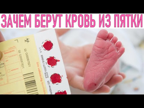 ЗАБОР КРОВИ ИЗ ПЯТКИ У НОВОРОЖДЕННОГО В РОДДОМЕ | Важность теста бланка для новорожденных